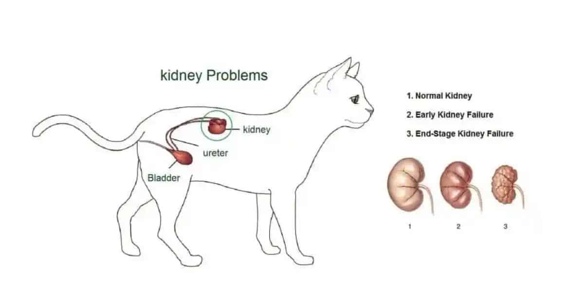 Kidney Disease